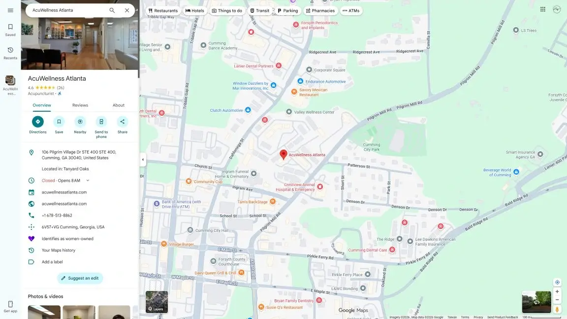 AcuWellness Atlanta Cumming location GBP map