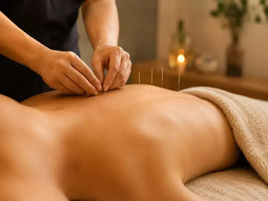 Privacy-safe acupuncture treatment detail at AcuWellness Atlanta
